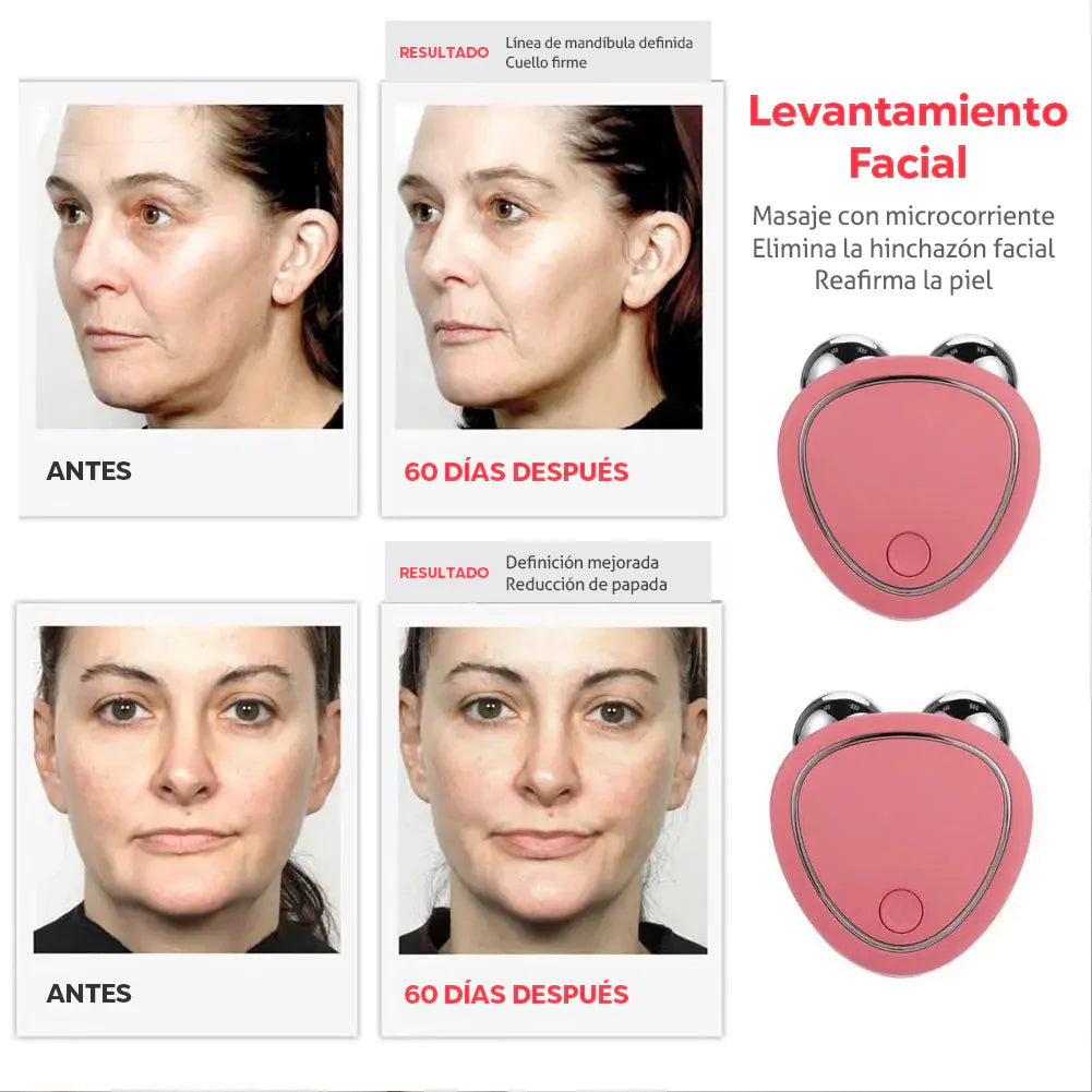 MASAJEADOR MICROCORRIENTE FACIAL